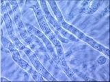   - <i>Aphanomyces astaci</i>