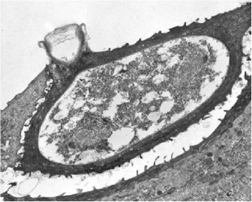 Лягушачий грибок-убийца - <i>Batrachochytrium dendrobatidis</i> Longcore Pessier & D.K. Nichols, 1999