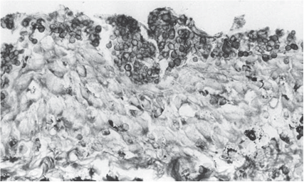 Лягушачий грибок-убийца - <i>Batrachochytrium dendrobatidis</i> Longcore Pessier & D.K. Nichols, 1999